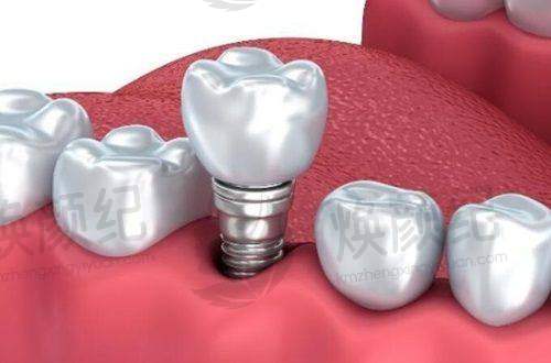 核心区别二:使用体验与耐用性,差异显著