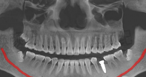核心区别三:适用人群与价格,精细匹配需求