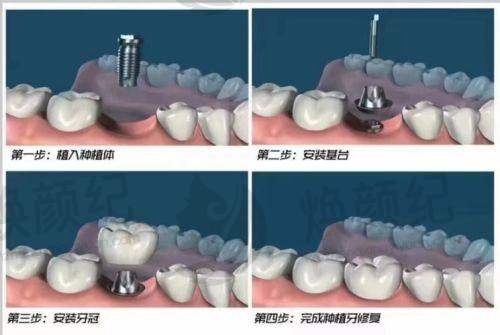 总结:怎么选更合适?
