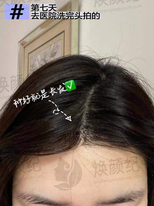 五、刘跃飞医生擅长项目有哪些