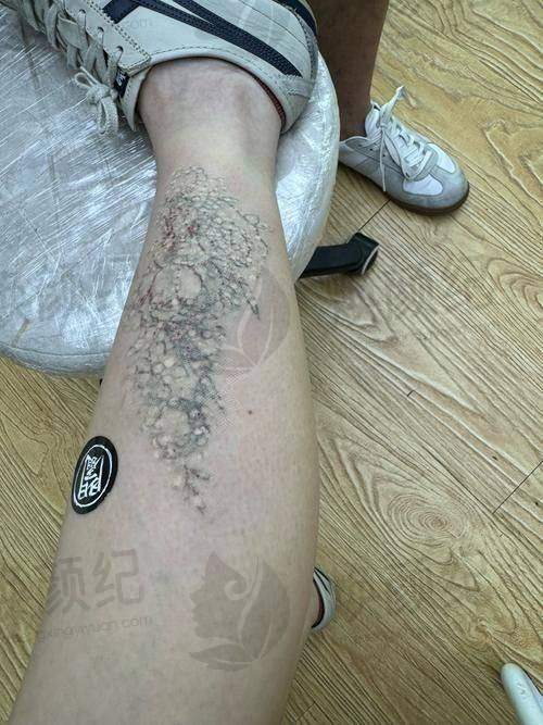 四、刘跃飞医生坐诊哪个医院？