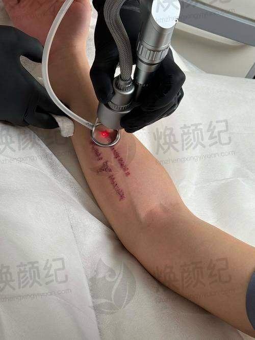 二、刘跃飞医生职称