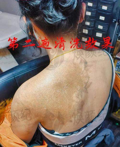 九、刘跃飞医生专精知识