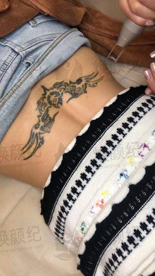 八、刘跃飞医生医美费用一览表