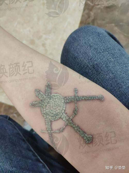 七、刘跃飞医生近期真实评价