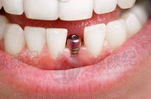 五、叶莹医生擅长项目有哪些