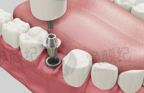 二、叶莹医生职称