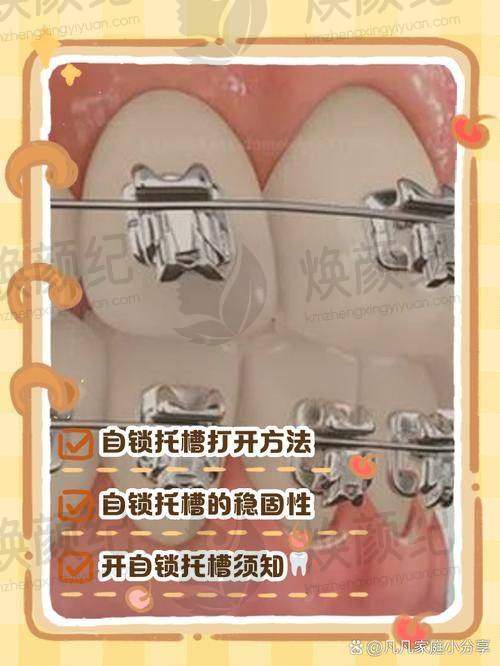 三、叶莹医生在口腔领域技术特长