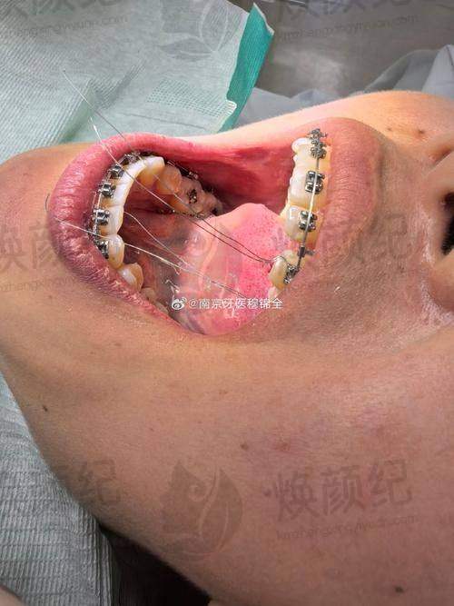 七、叶莹医生近期真实评价