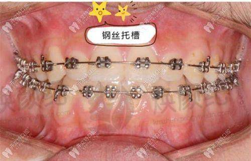 四、叶莹医生坐诊哪个医院?