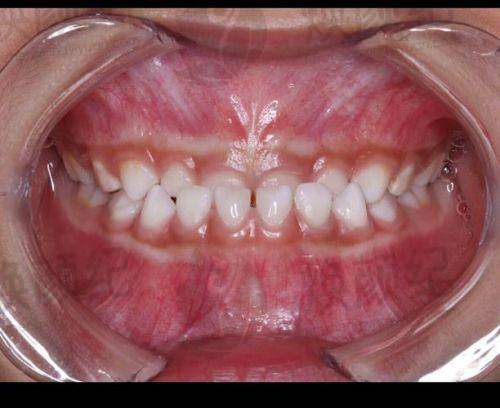 八、叶莹医生口腔费用一览表