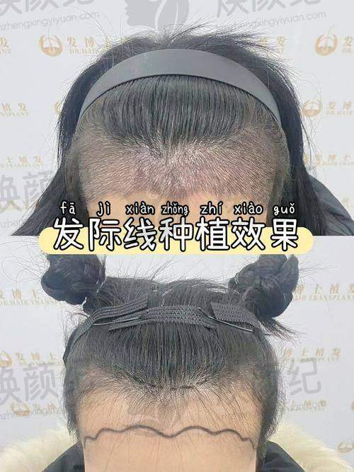 三、林于樱医生在医美领域技术特长