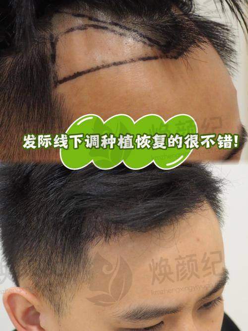 五、林于樱医生擅长项目有哪些