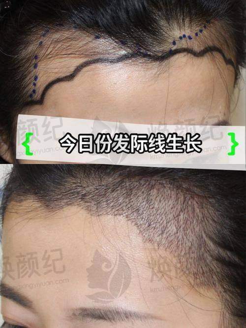 九、林于樱医生专精知识