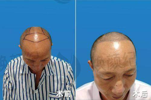 七、林于樱医生近期真实评价