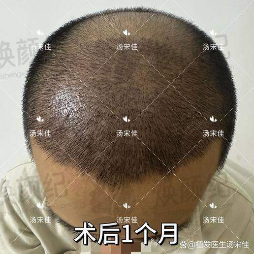 四、林于樱医生坐诊哪个医院？