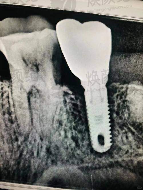 七、陶良峰医生近期真实评价