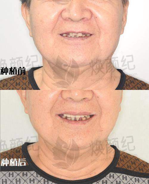 六、陶良峰医生预约挂号出诊时间