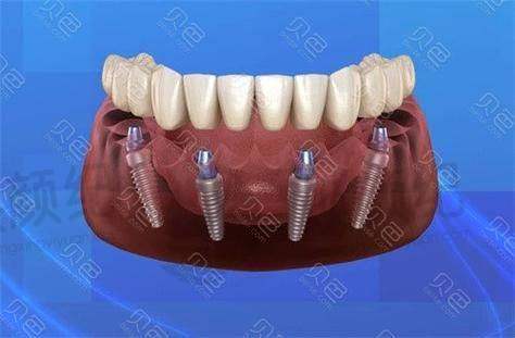 八、陶良峰医生口腔费用一览表