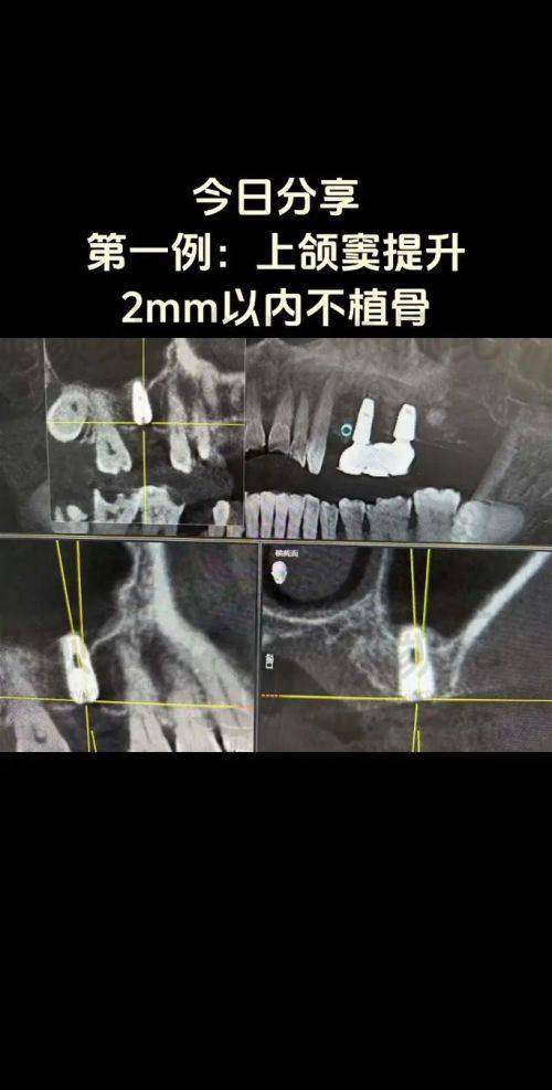 九、陶良峰医生专精知识