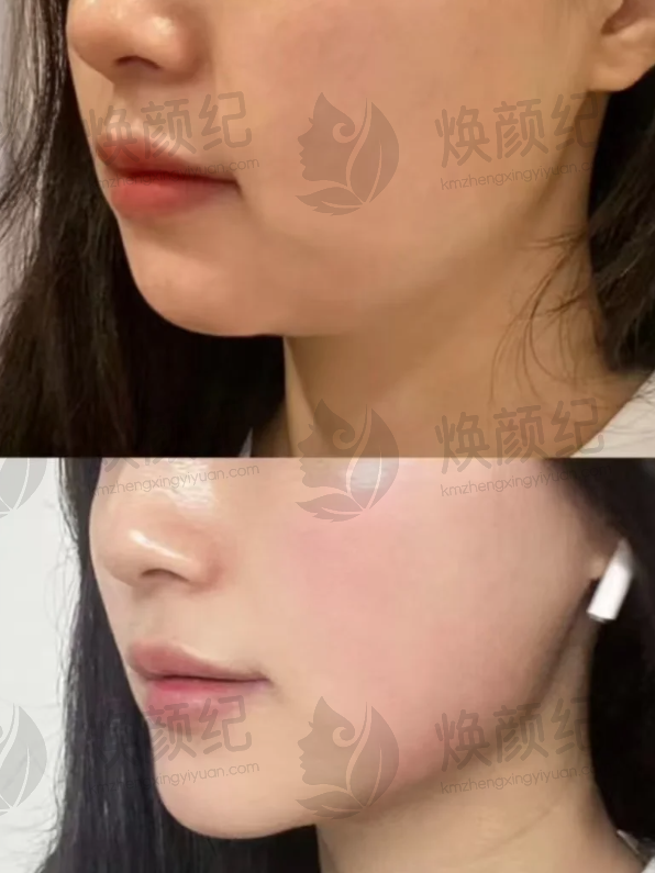 五、孙玮骏医生擅长项目有哪些