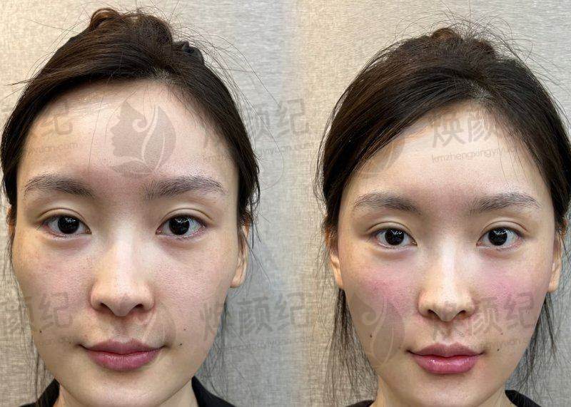 七、孙玮骏医生近期真实评价