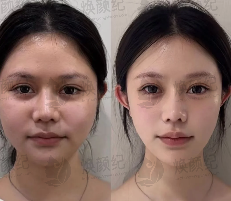 八、孙玮骏医生医美费用一览表