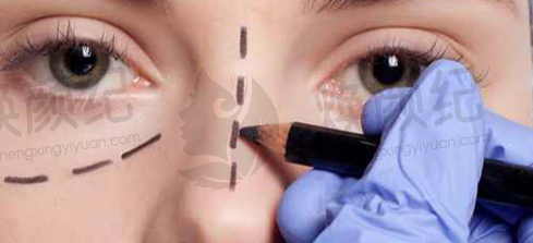 五、周晨曦医生擅长项目有哪些