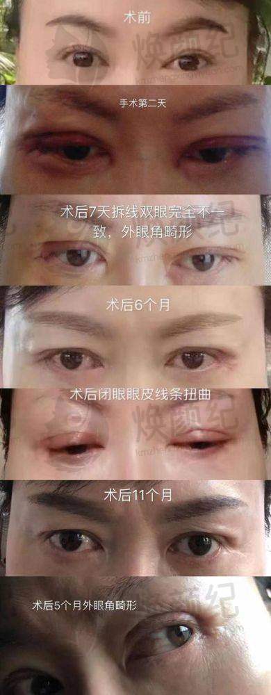 七、周晨曦医生近期真实评价