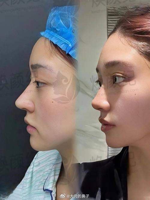 三、周晨曦医生在医美领域技术特长