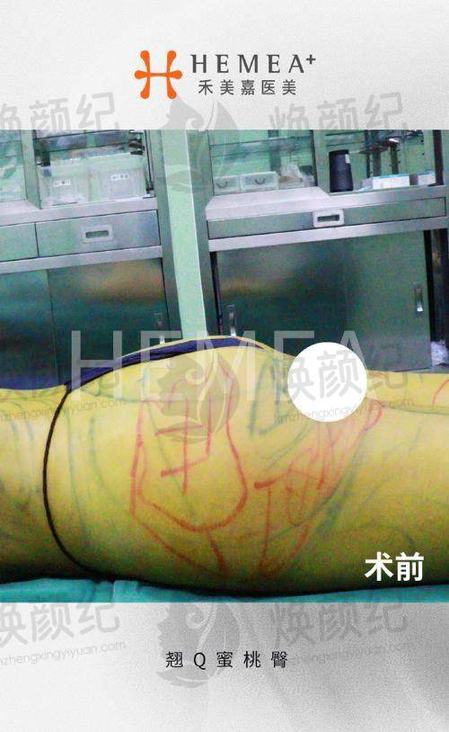 六、赵学汉医生预约挂号出诊时间