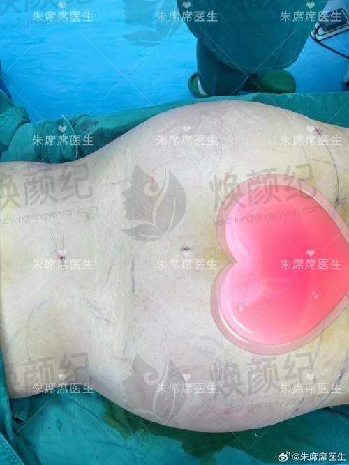 三、赵学汉医生在医美领域技术特长