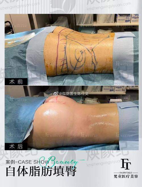 五、赵学汉医生擅长项目有哪些