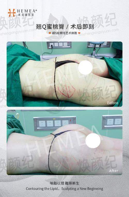 七、赵学汉医生近期真实评价