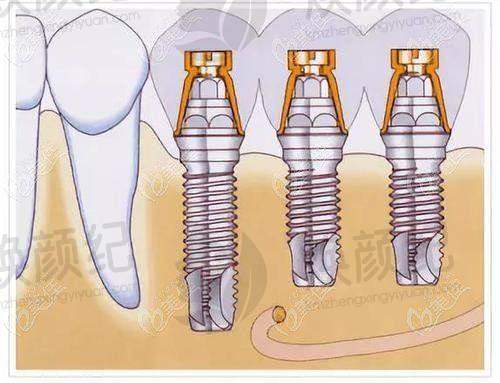 五、张姝琳医生擅长项目有哪些