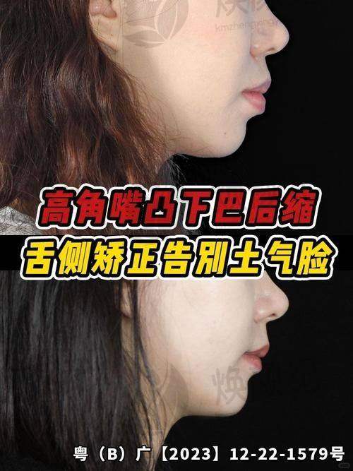 三、张姝琳医生在口腔领域技术特长