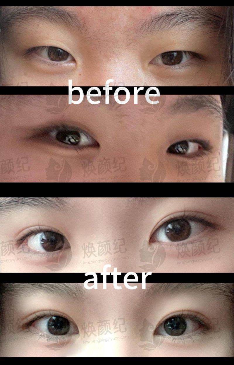 八、周晨曦医生医美费用一览表