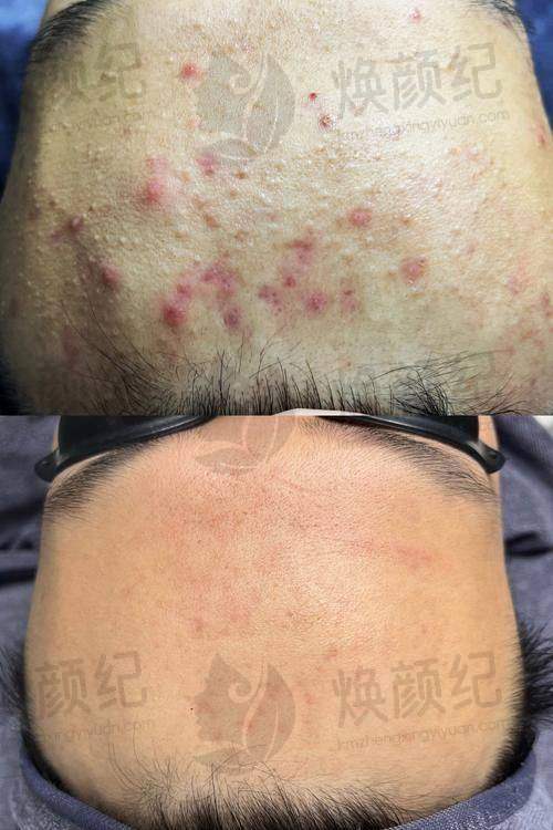 五、戴志刚医生擅长项目有哪些