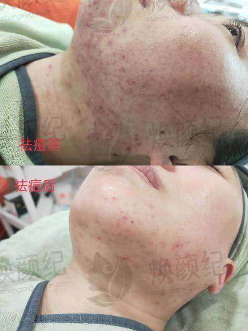 七、戴志刚医生近期真实评价