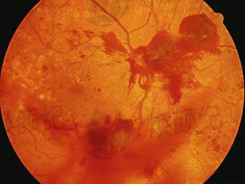 六、吕同府医生预约挂号出诊时间