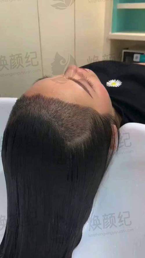 三、戴志刚医生在医美领域技术特长