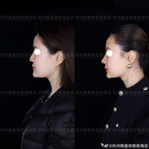 五、金大暎医生擅长项目有哪些