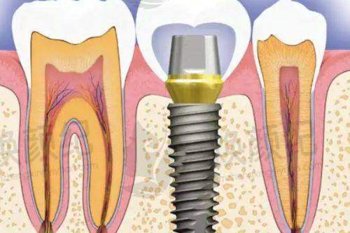 三、绍兴柯桥柯隆口腔核心科室与特色项目
