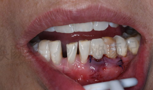 二、山东临沂兰山登超口腔诊所医生团队,打造专精诊疗服务