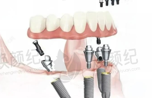 三、河南郑州未来口腔门诊部核心科室与特色项目