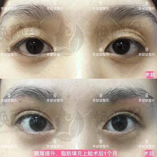 三、烟台毓璜顶医院烧伤美容整形中 心核心科室与特色项目