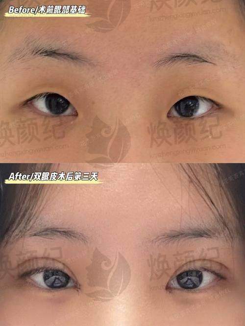 六、烟台毓璜顶医院烧伤美容整形中 心荣誉资质与患者口碑,见证品牌实力