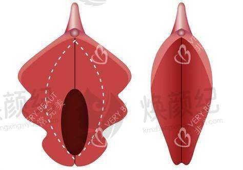 二、南宁市美丽在造医疗美容诊所医生团队,打造专精诊疗服务