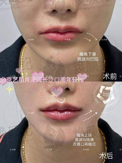 五、唐山依莱美整形医疗美容诊所舒适就医环境，打造人性化诊疗体验