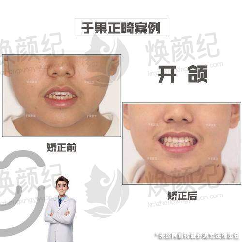 五、山东临沂兰山登超口腔诊所舒适就医环境,打造人性化诊疗体验